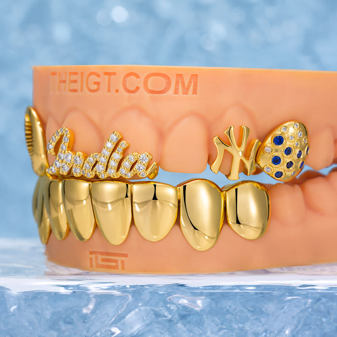 NYC Feather & Gold Grillz