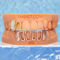 "Opal Halo" Iced Open-Face Grillz