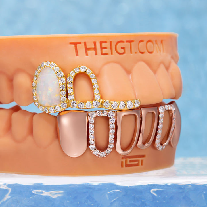 "Opal Halo" Iced Open-Face Grillz