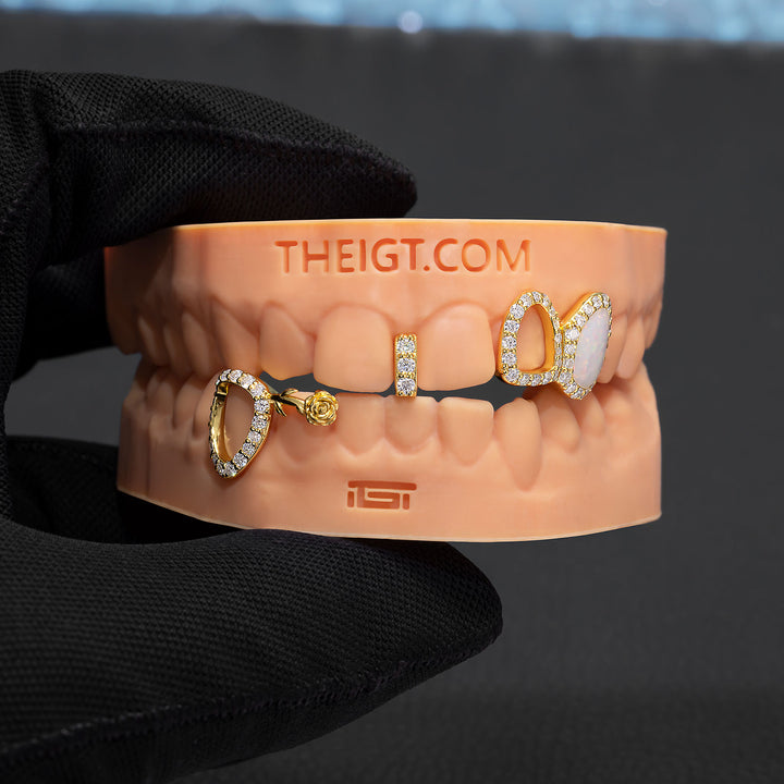 Opal Rose Iced Open-Face Grillz