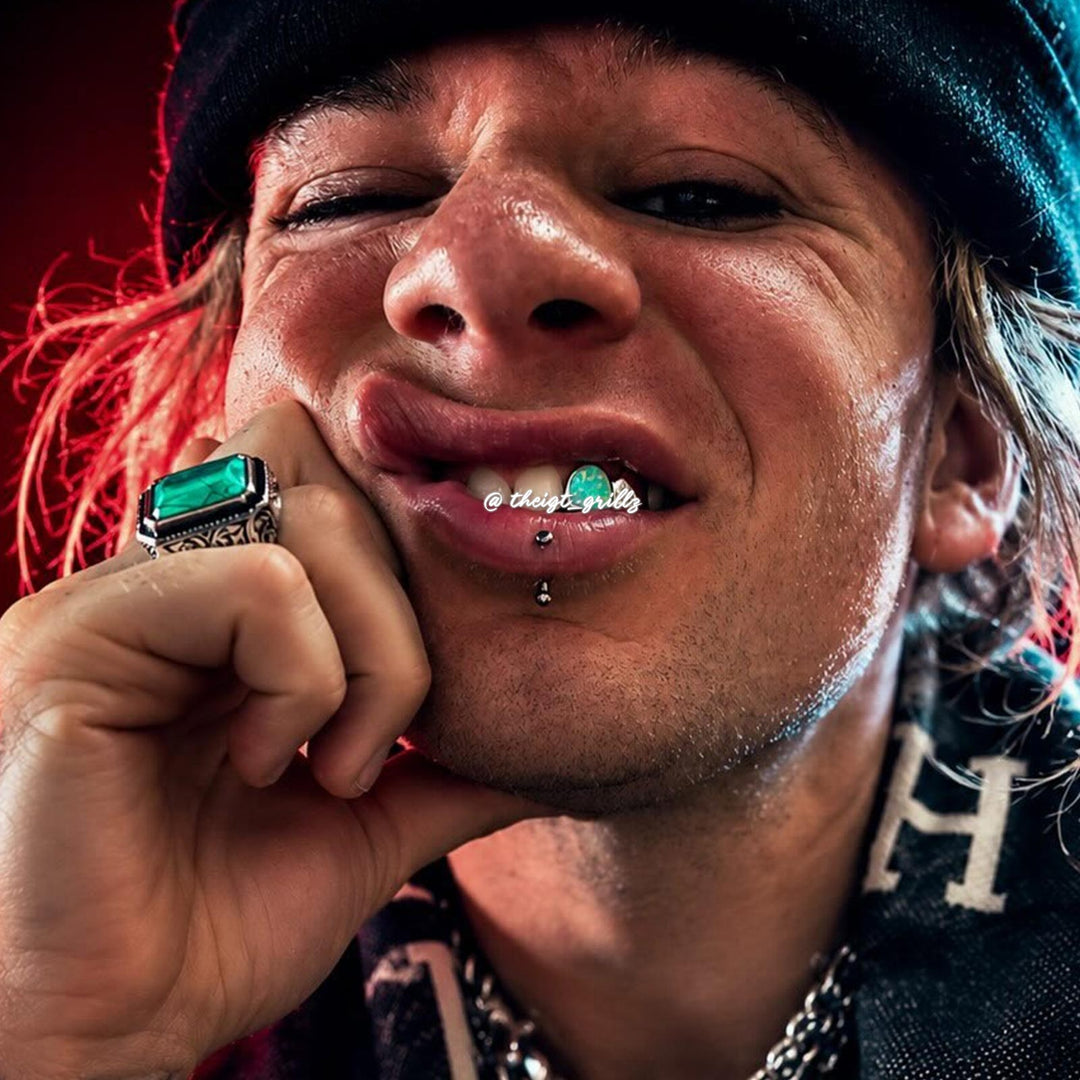 Opal With Oval Cut Style Grillz