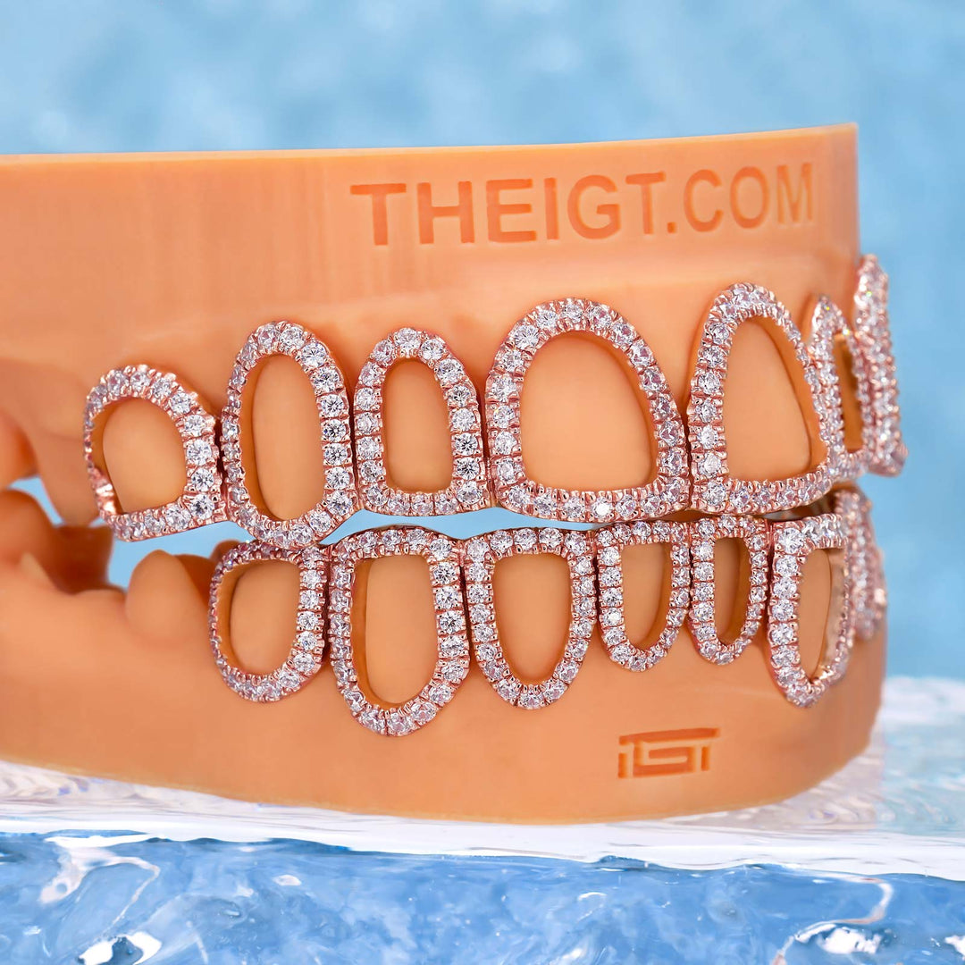 Open Face Diamond Grillz