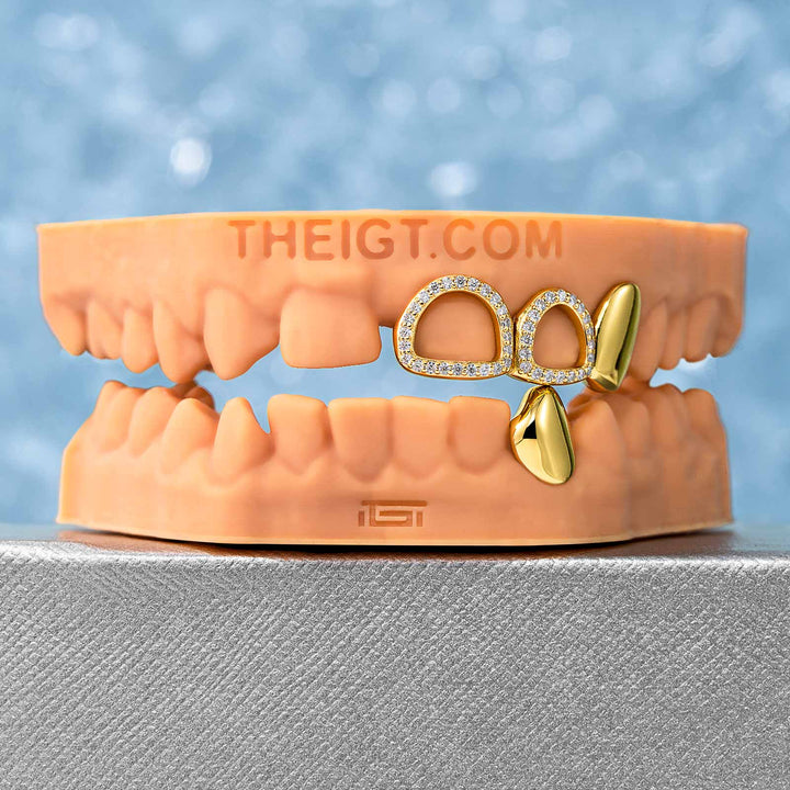Open Face W Solid Fang Grillz