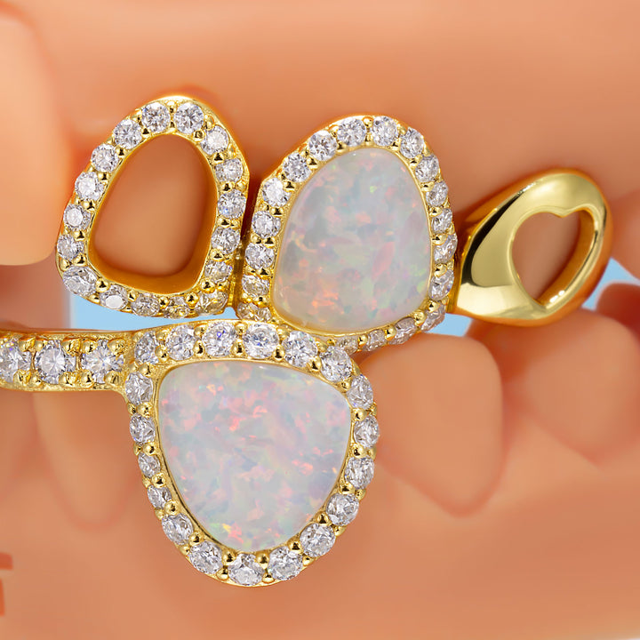Open Face With Diamond Opal Grillz