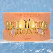 Open Face Pink Shell Grillz