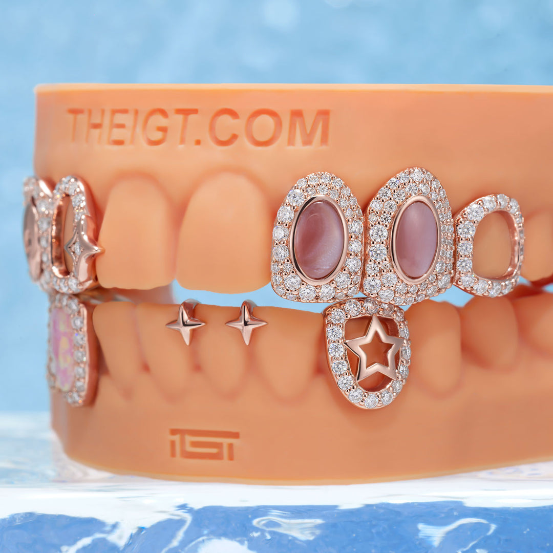 "Pink Bloom" Opal Grillz