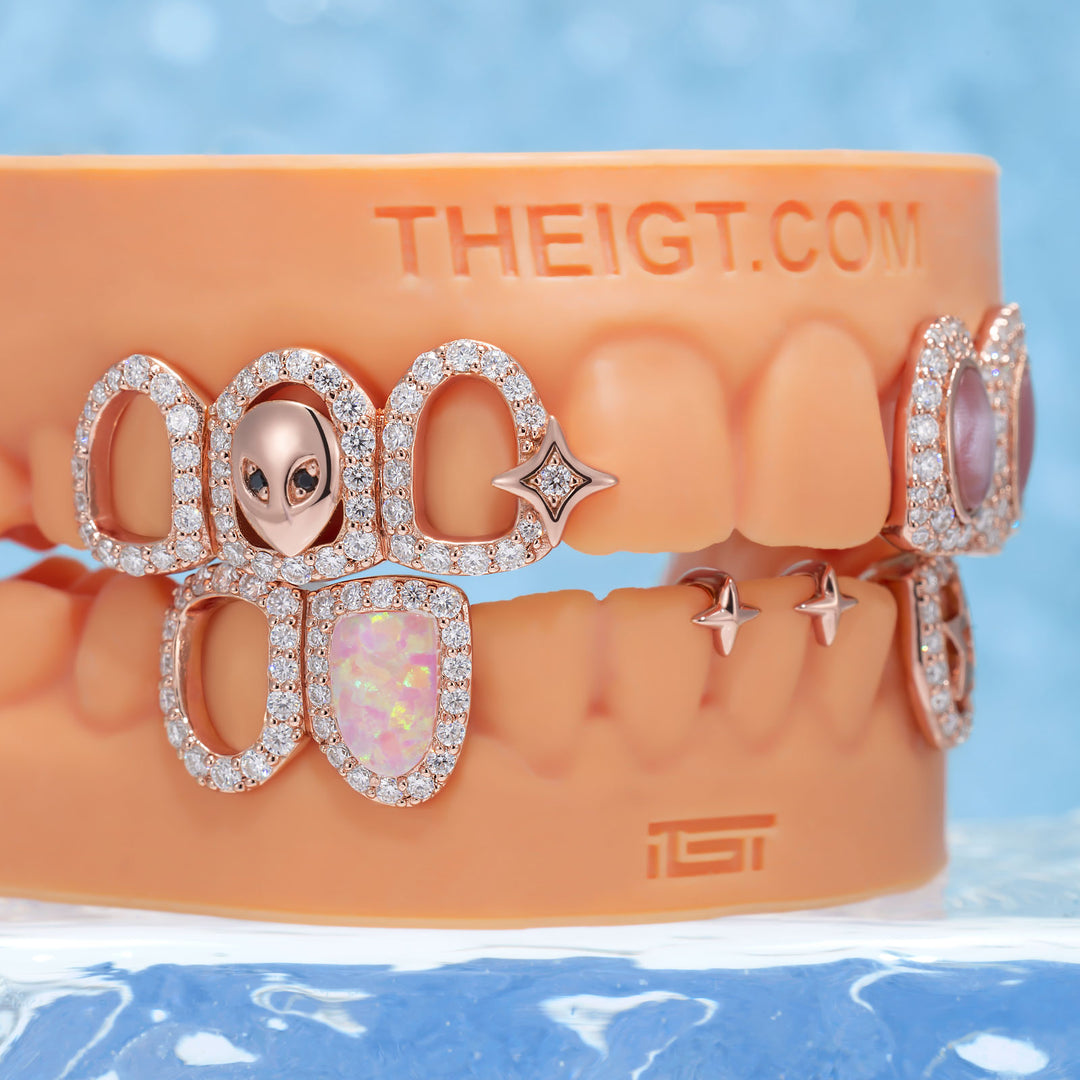 "Pink Bloom" Opal Grillz