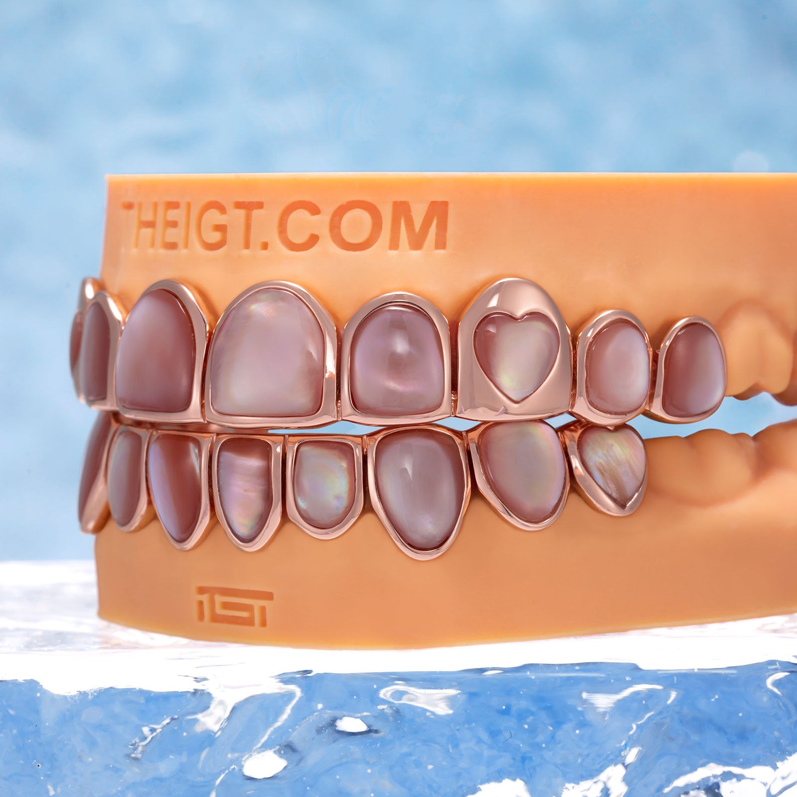 Pink Grillz – Iridescent Shell Design | TheIGT Jewelry – ICEGIANT