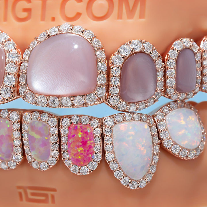 Pink Shell & Opal Diamond Grillz Set
