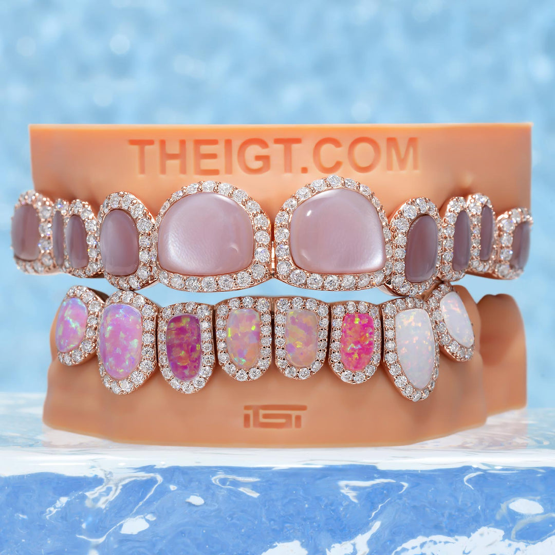 Pink Shell & Opal Diamond Grillz Set