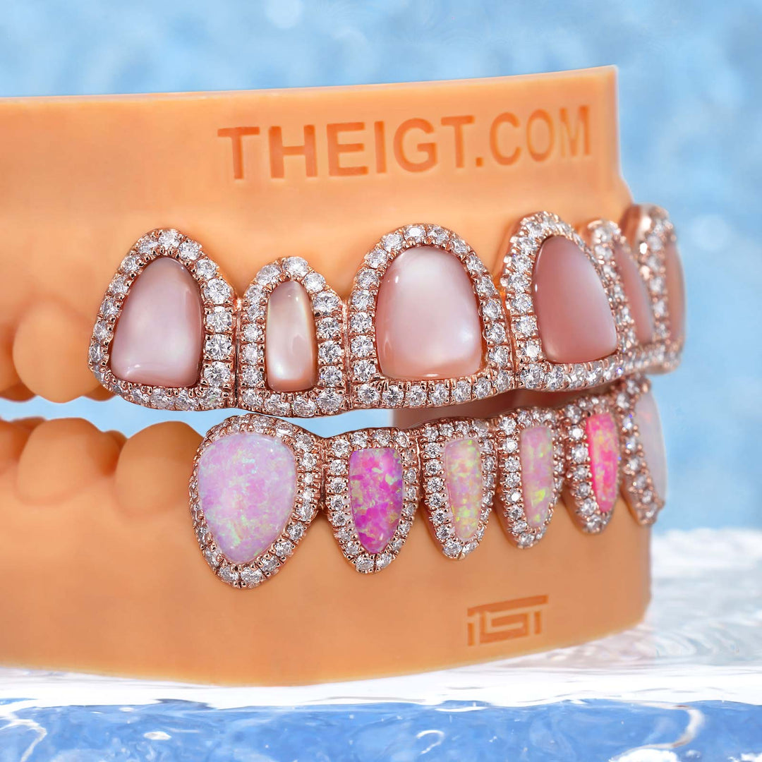 Pink Shell & Opal Diamond Grillz Set