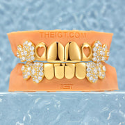 Polish Gold With lced Fangs Grillz
