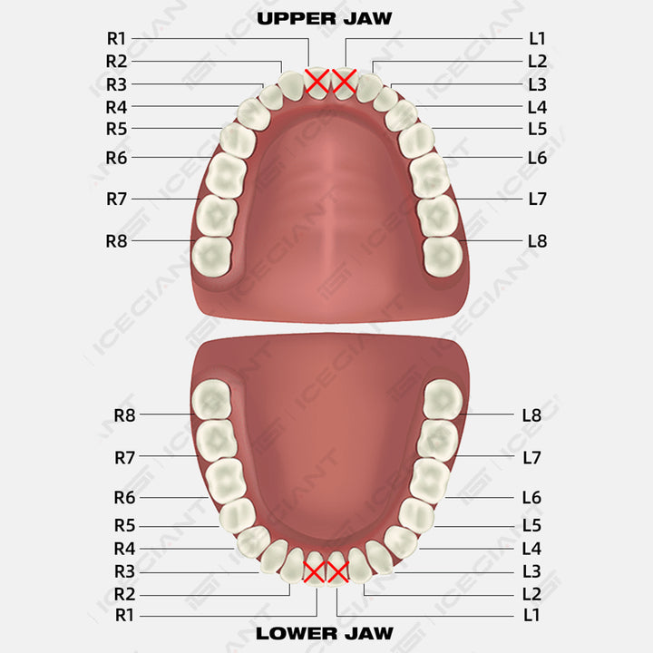 Open Face With Heart Style Grillz