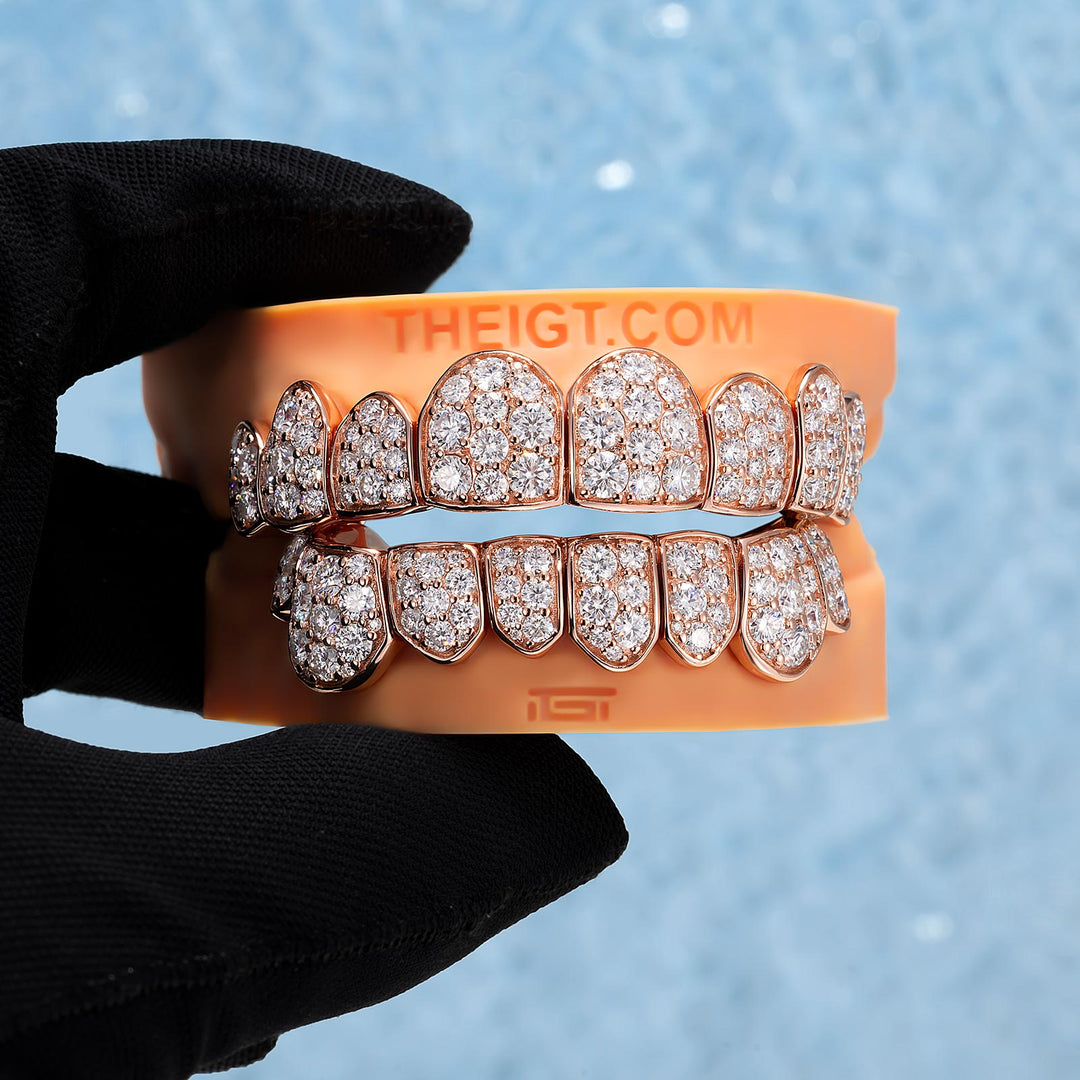 Custom Giant (15 Pointers) Moissanite Diamond Grillz