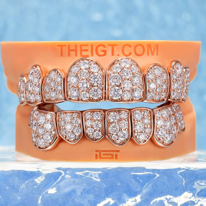 Custom Giant (15 Pointers) Moissanite Diamond Grillz