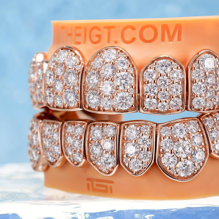 Custom Giant (15 Pointers) Moissanite Diamond Grillz