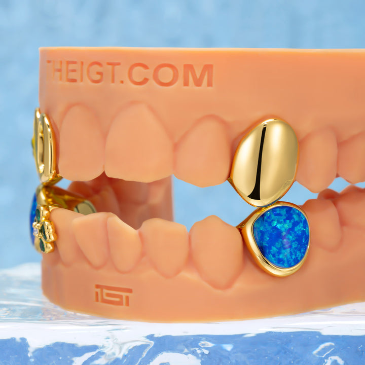 "St. Vincent Flag" Opal & Clover Grillz