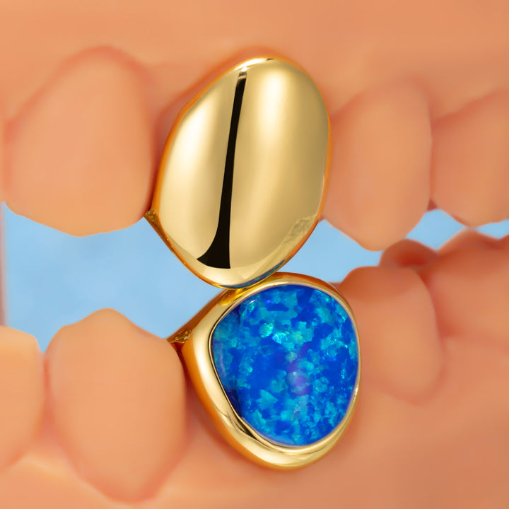 "St. Vincent Flag" Opal & Clover Grillz