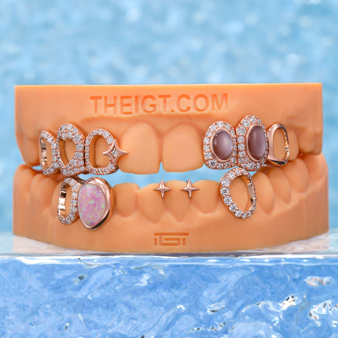Star & Opal Diamond Grillz