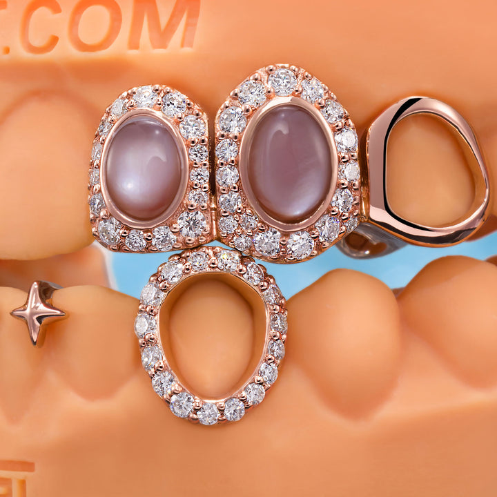 Star & Opal Diamond Grillz