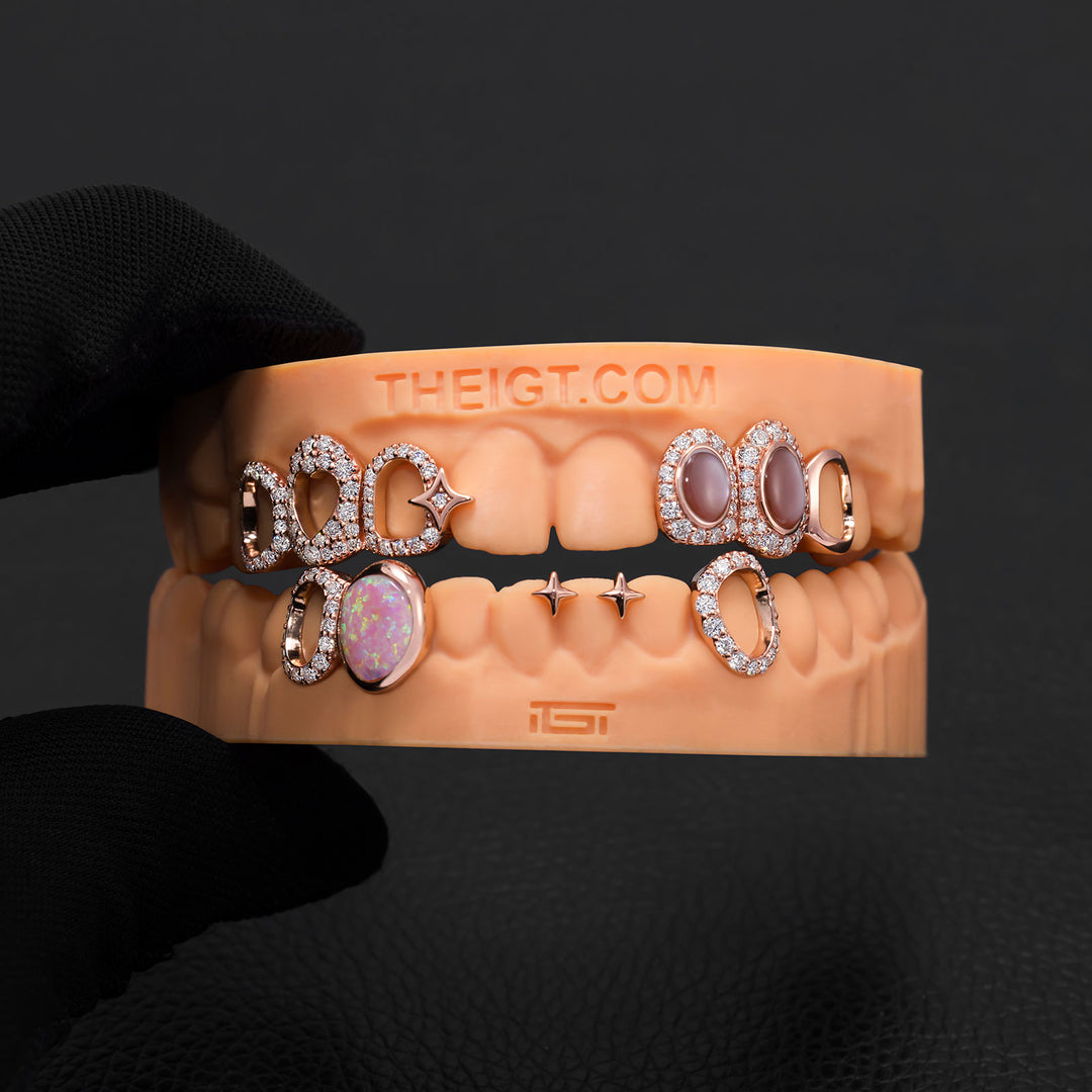 Star & Opal Diamond Grillz