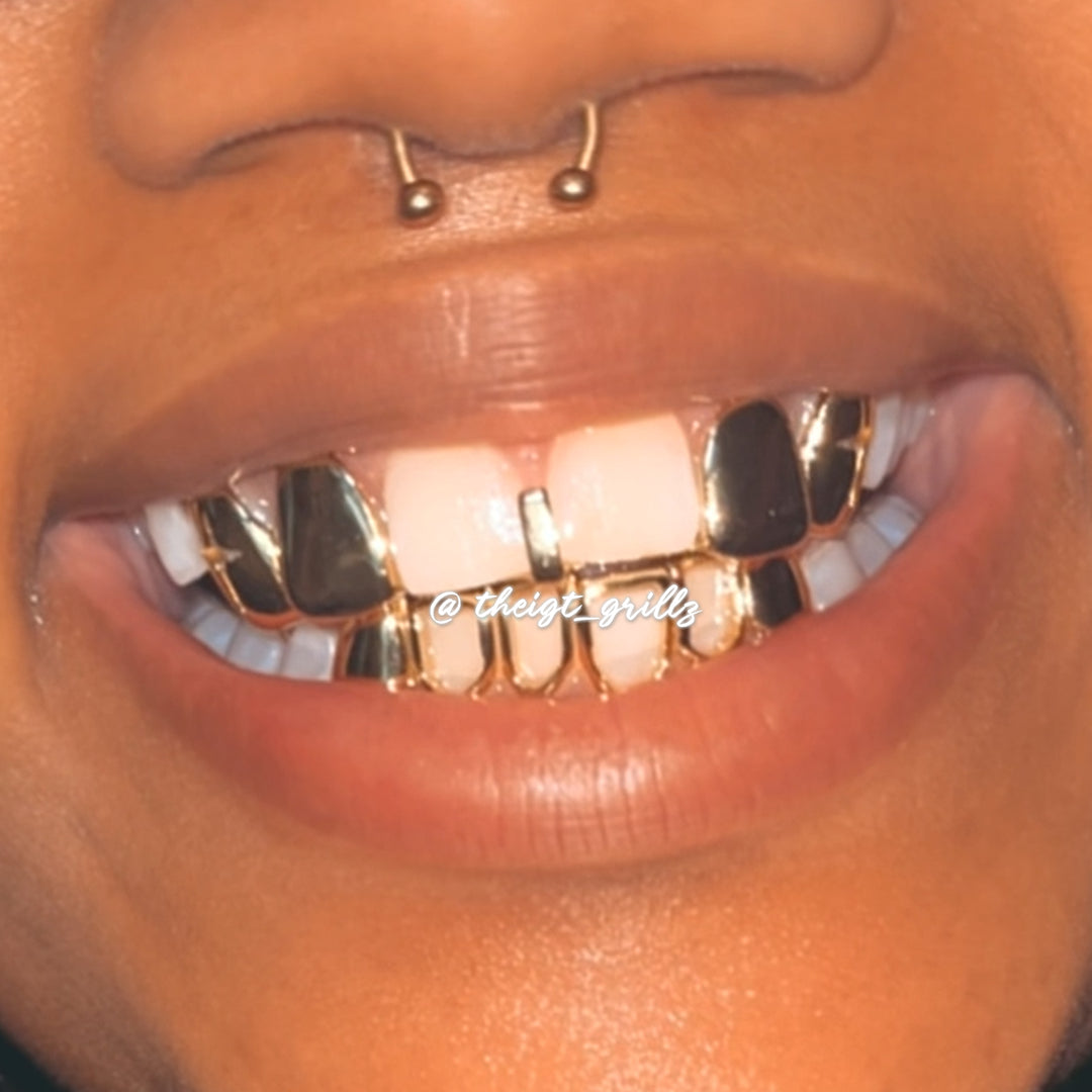 "Starburst Star" Open-Face Custom Grillz