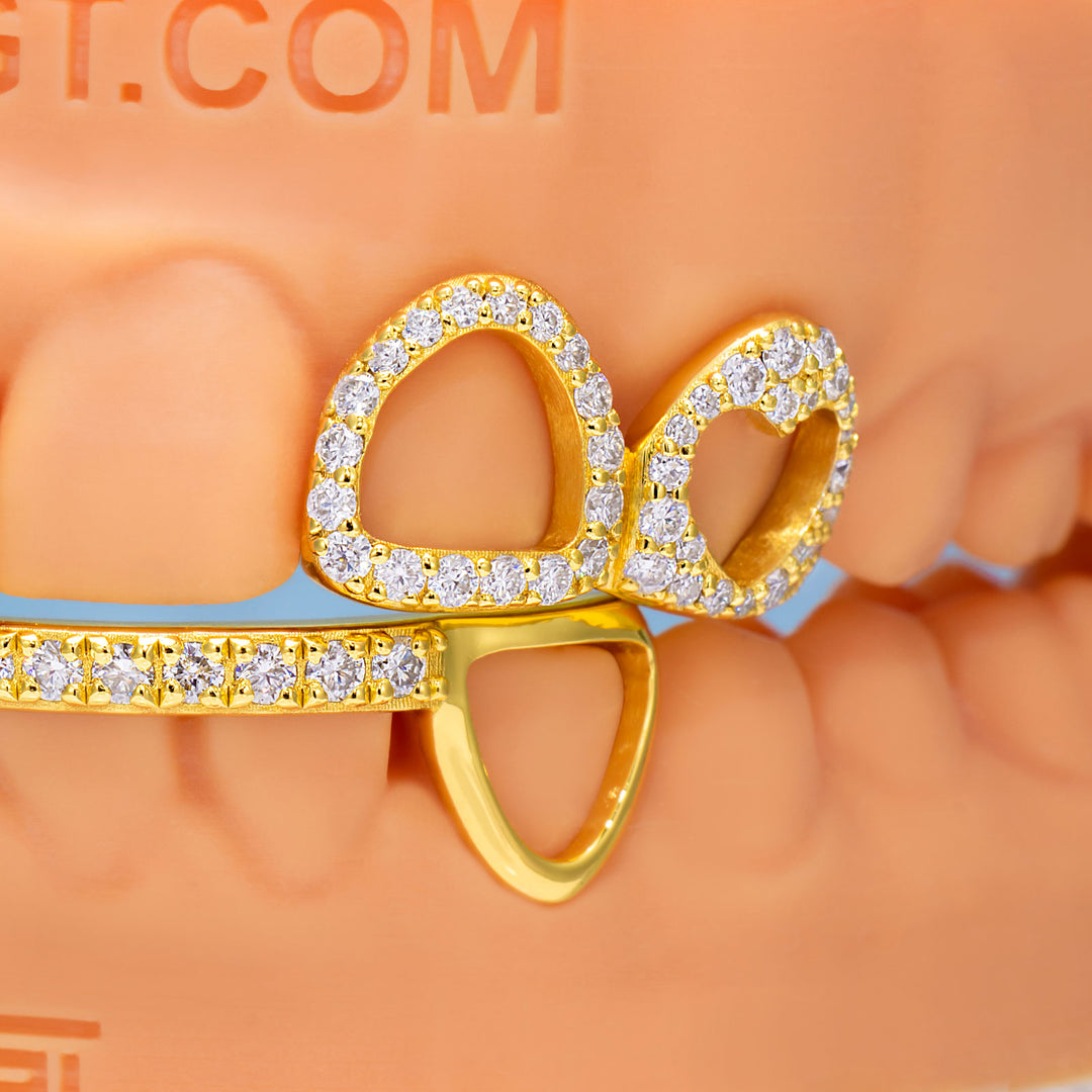 Top 4 Open Face With Bottom Bar Grillz