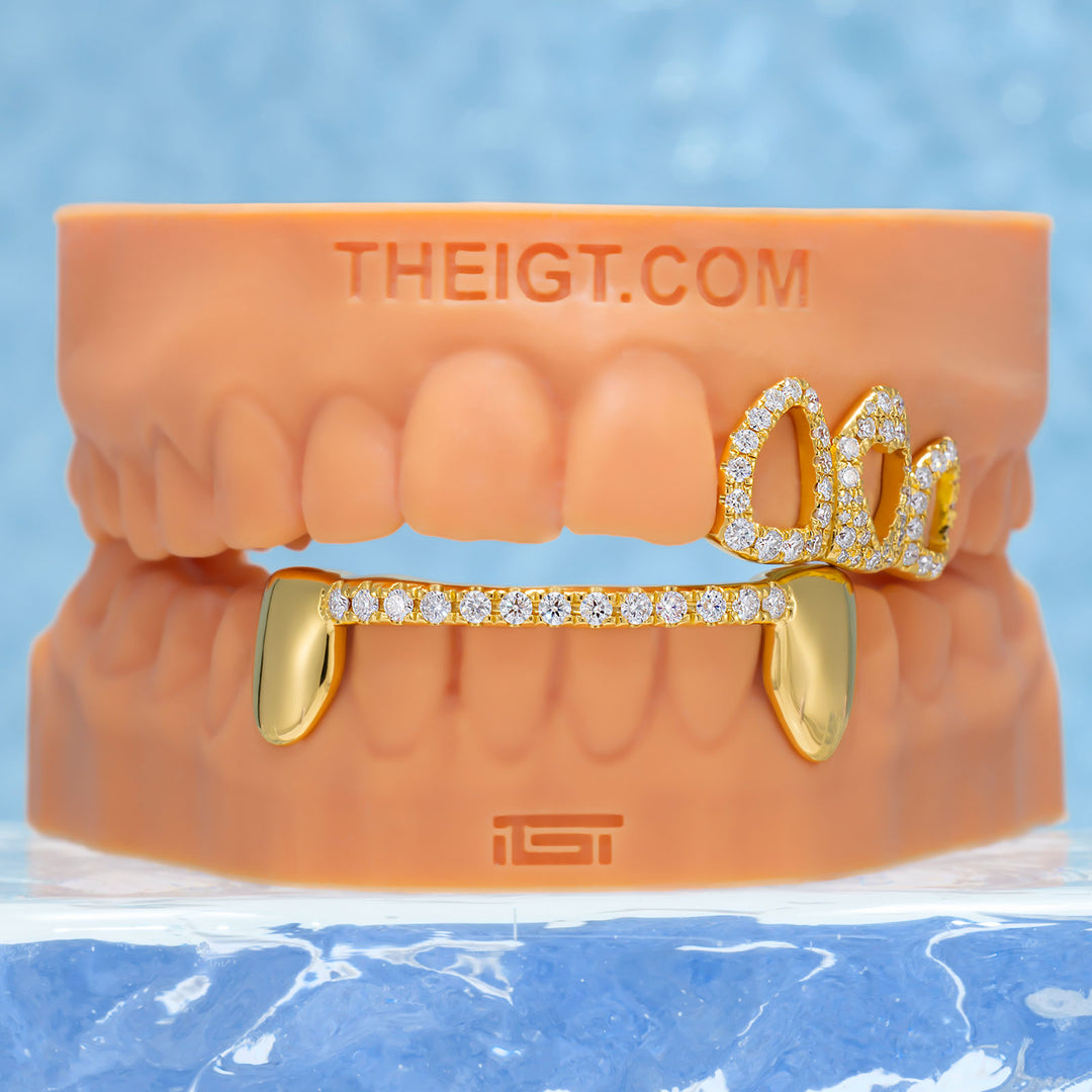 Top 4 Open Face With Bottom Bar Grillz