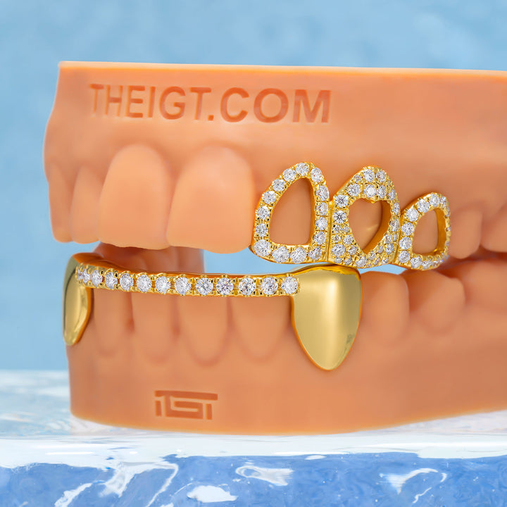 Top 4 Open Face With Bottom Bar Grillz