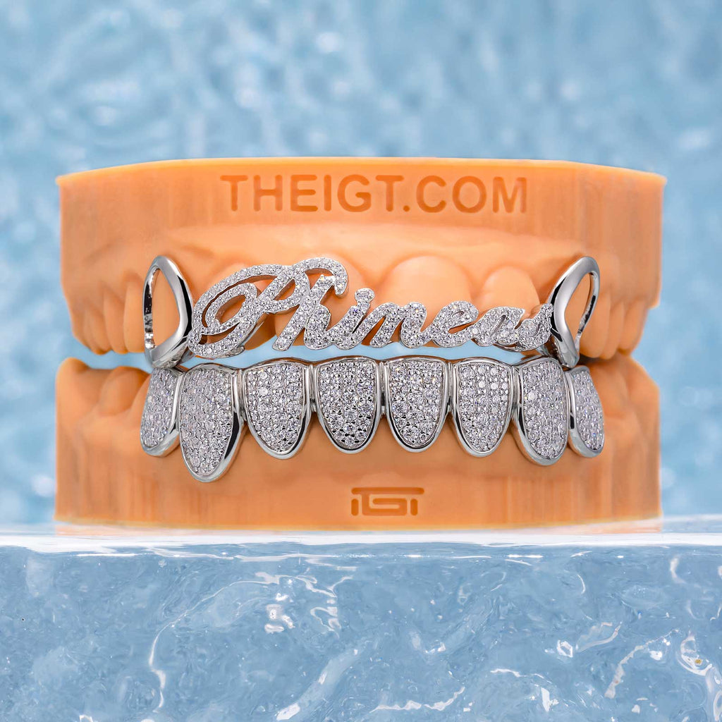 Diamond Grillz on Teeth – Custom Name Design | TheIGT – ICEGIANT