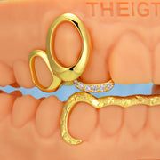 Top Open Face W Bottom Bar Grillz