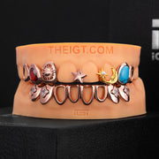 Turquoise & Ruby Open Face Grillz