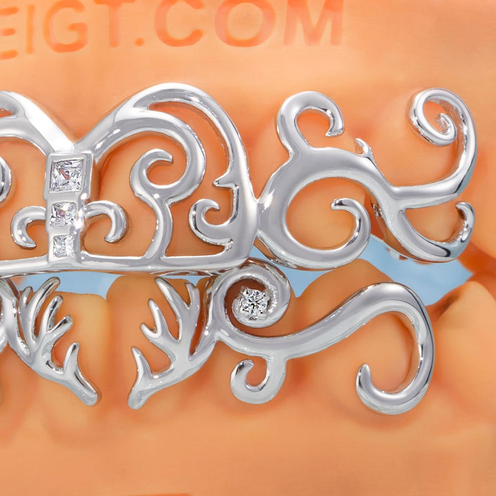 Moissanite Whimsy Deer Grillz