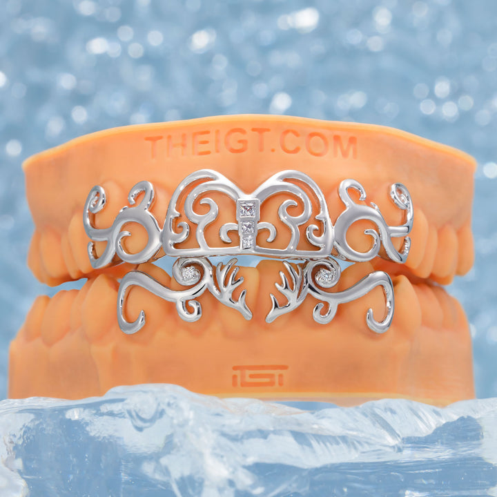 Moissanite Whimsy Deer Grillz