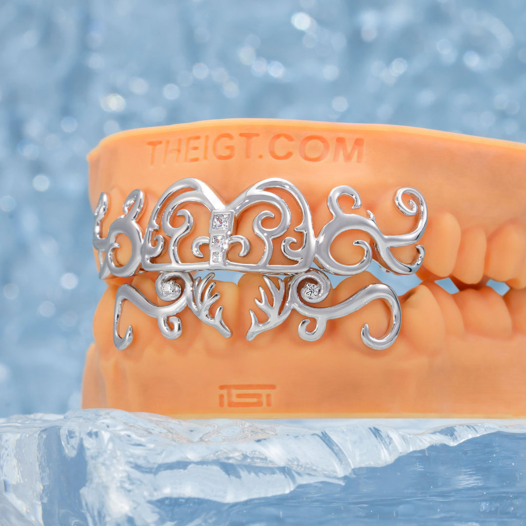 Moissanite Whimsy Deer Grillz