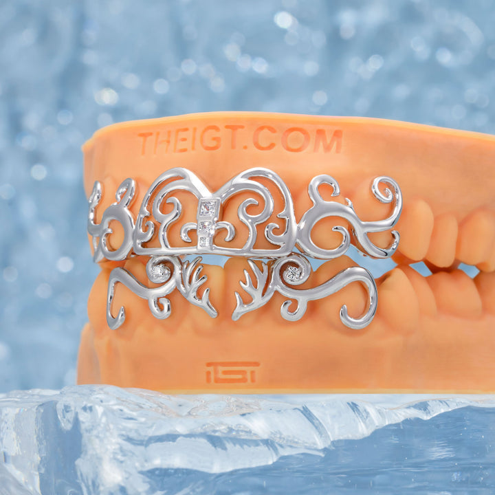 Moissanite Whimsy Deer Grillz