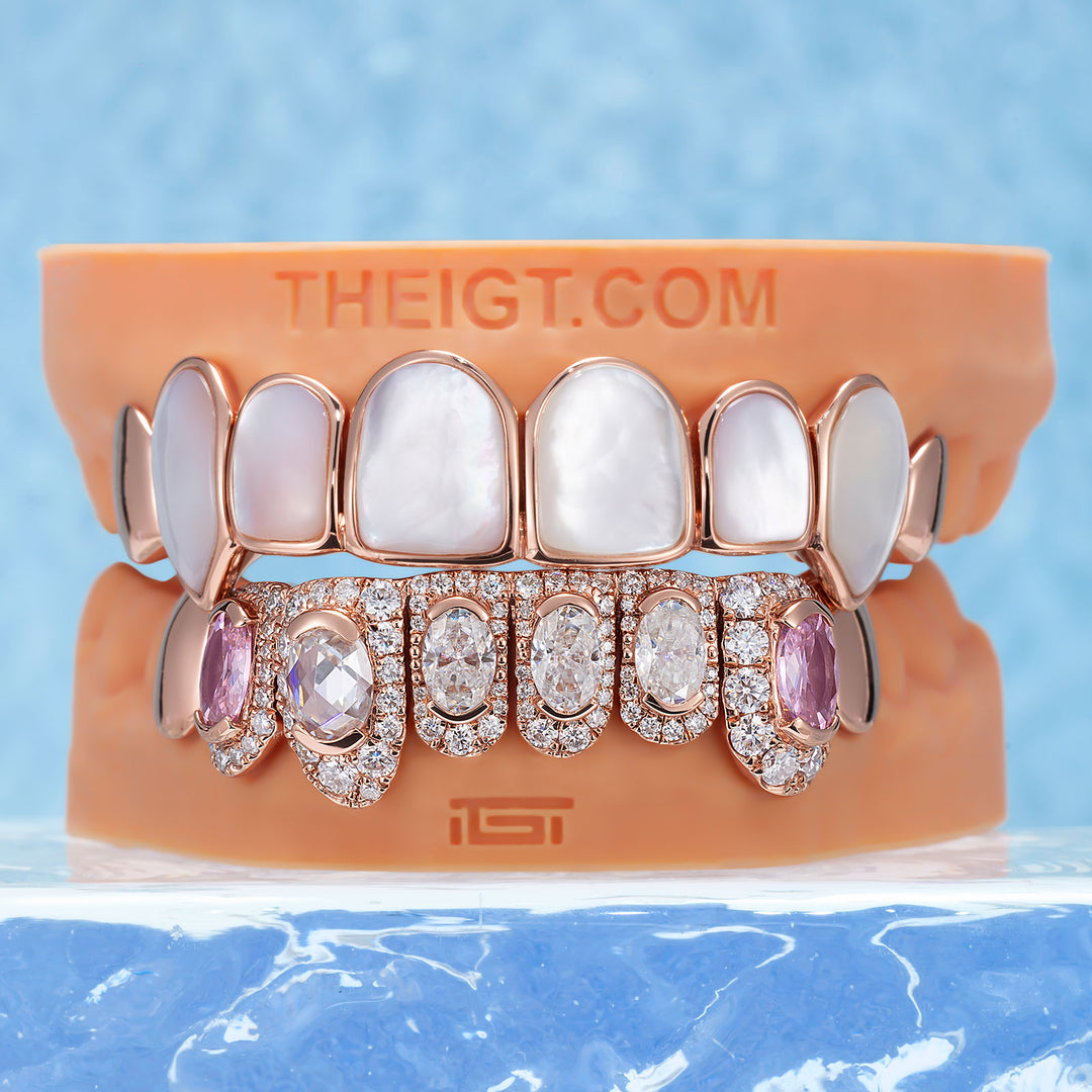 White Shell & Oval Cut Diamond Grillz