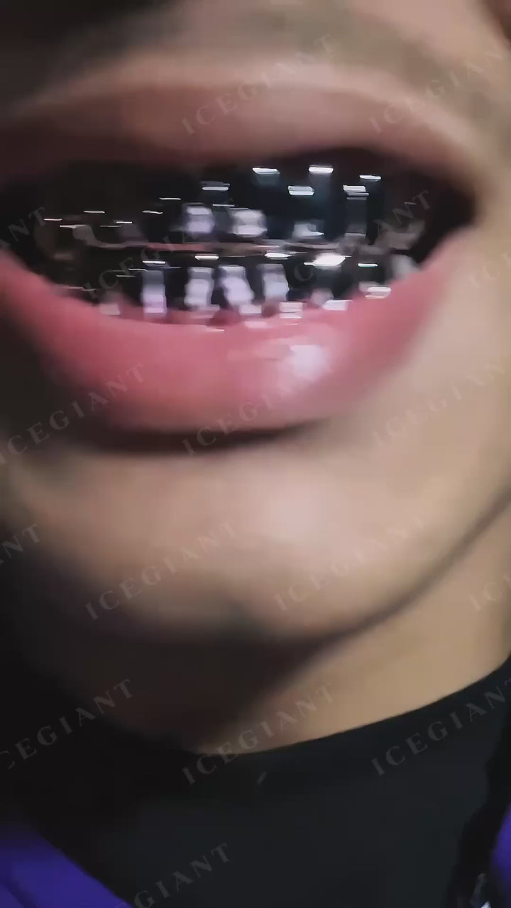 Custom Polished Gold Grillz