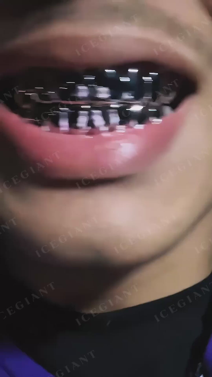 Custom Gold Grillz - Polished to Perfection | [Your Brand] – ICEGIANT