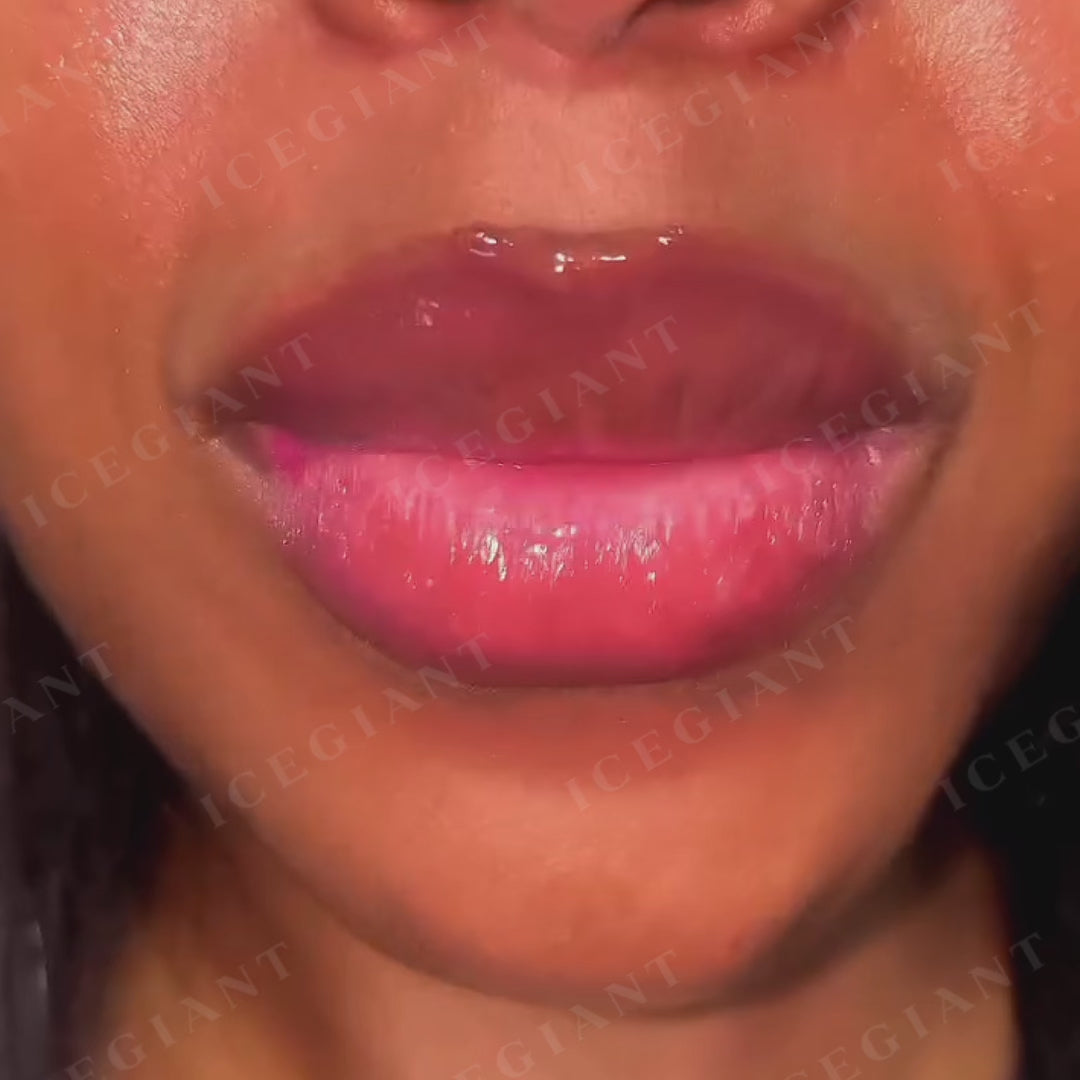 Flower & Stained Glass Style Grillz