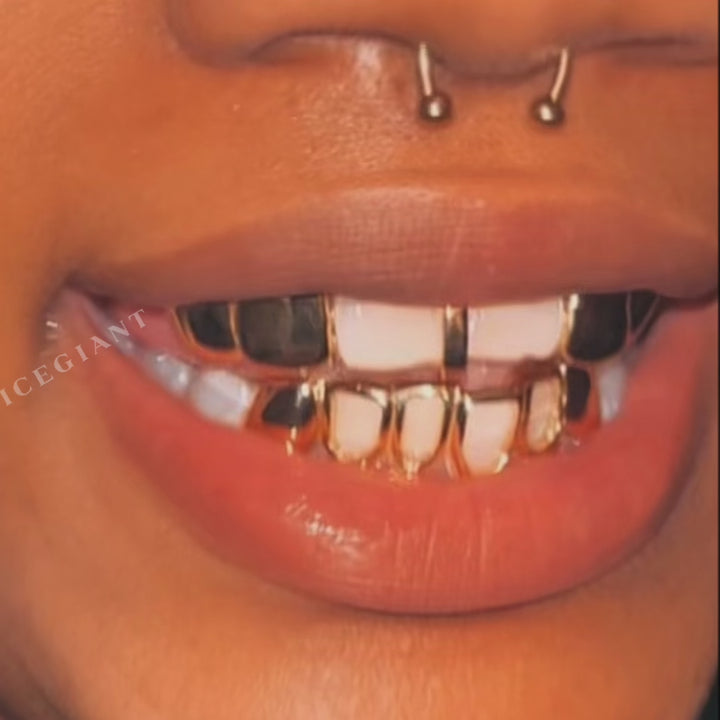 "Starburst Star" Open-Face Custom Grillz