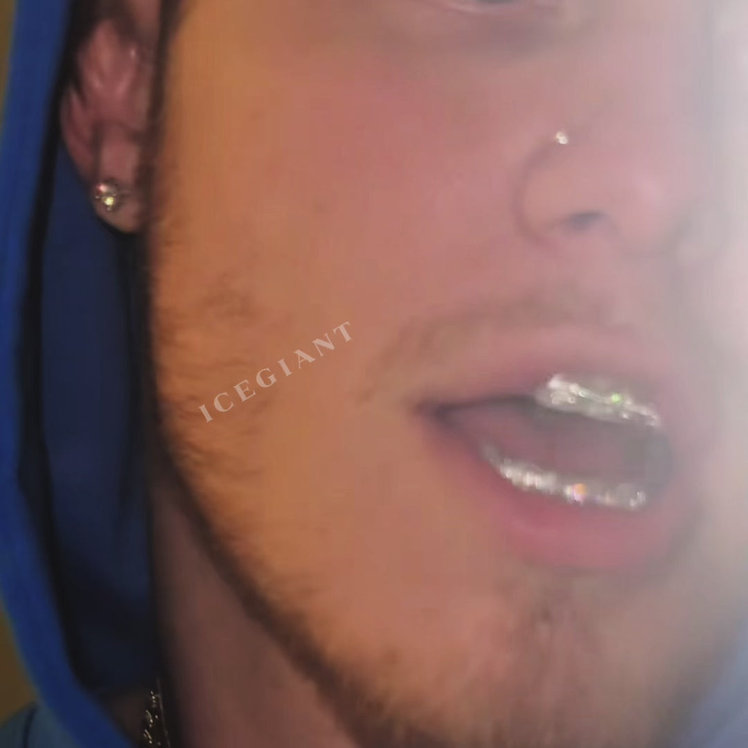 Rectangular Cut Brace Style Grillz