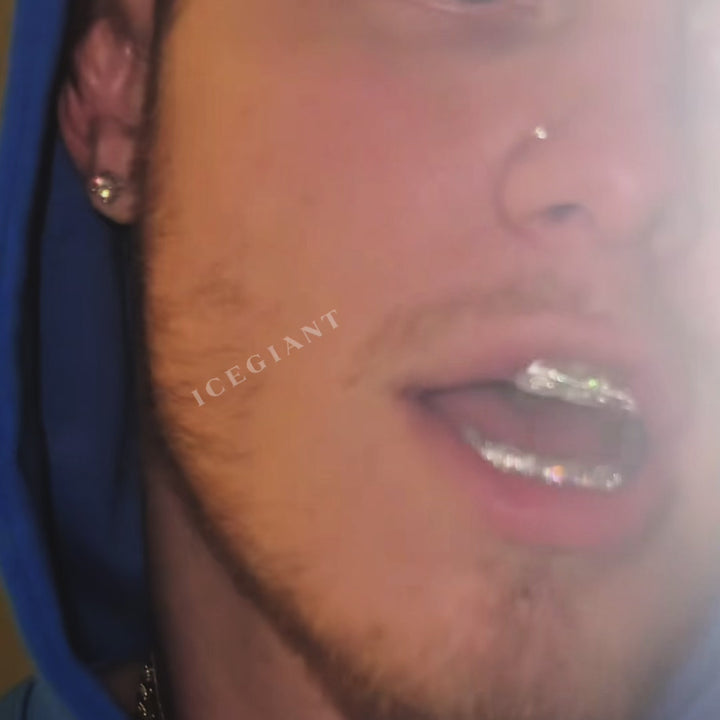 Rectangular Cut Brace Style Grillz