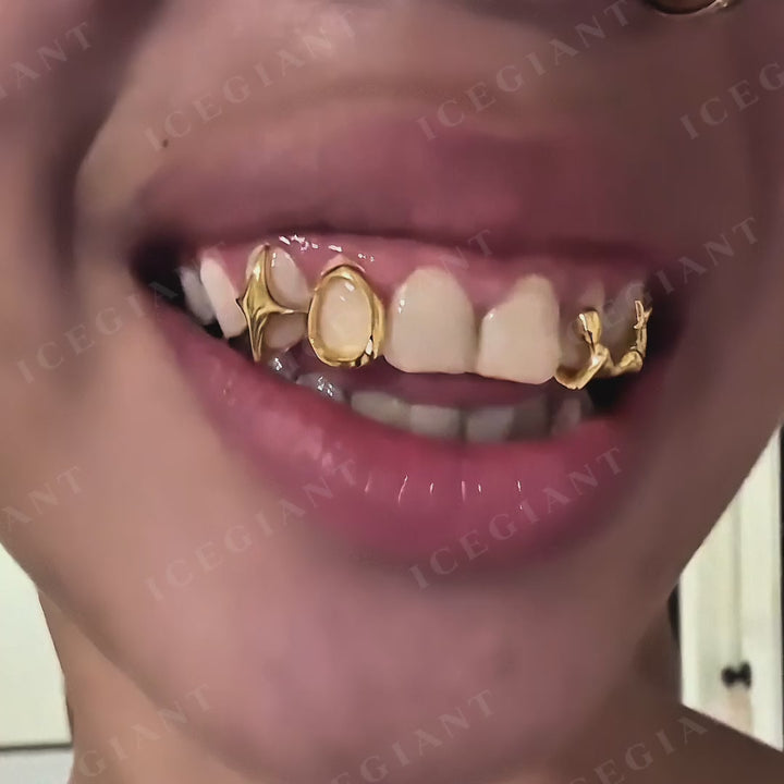 Starlight Dream Grillz
