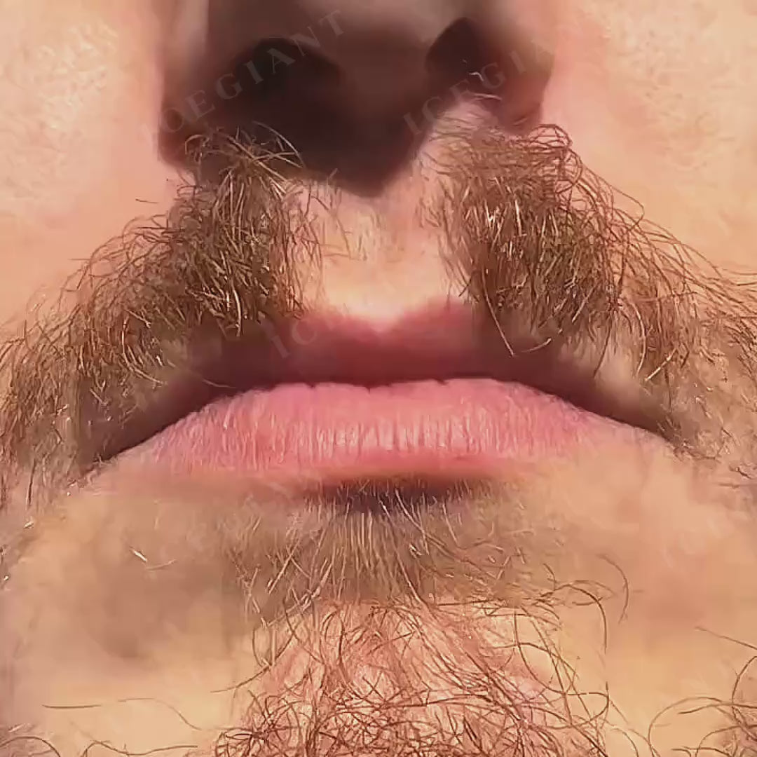 Custom Fully Iced Honeycomb Setting Grillz