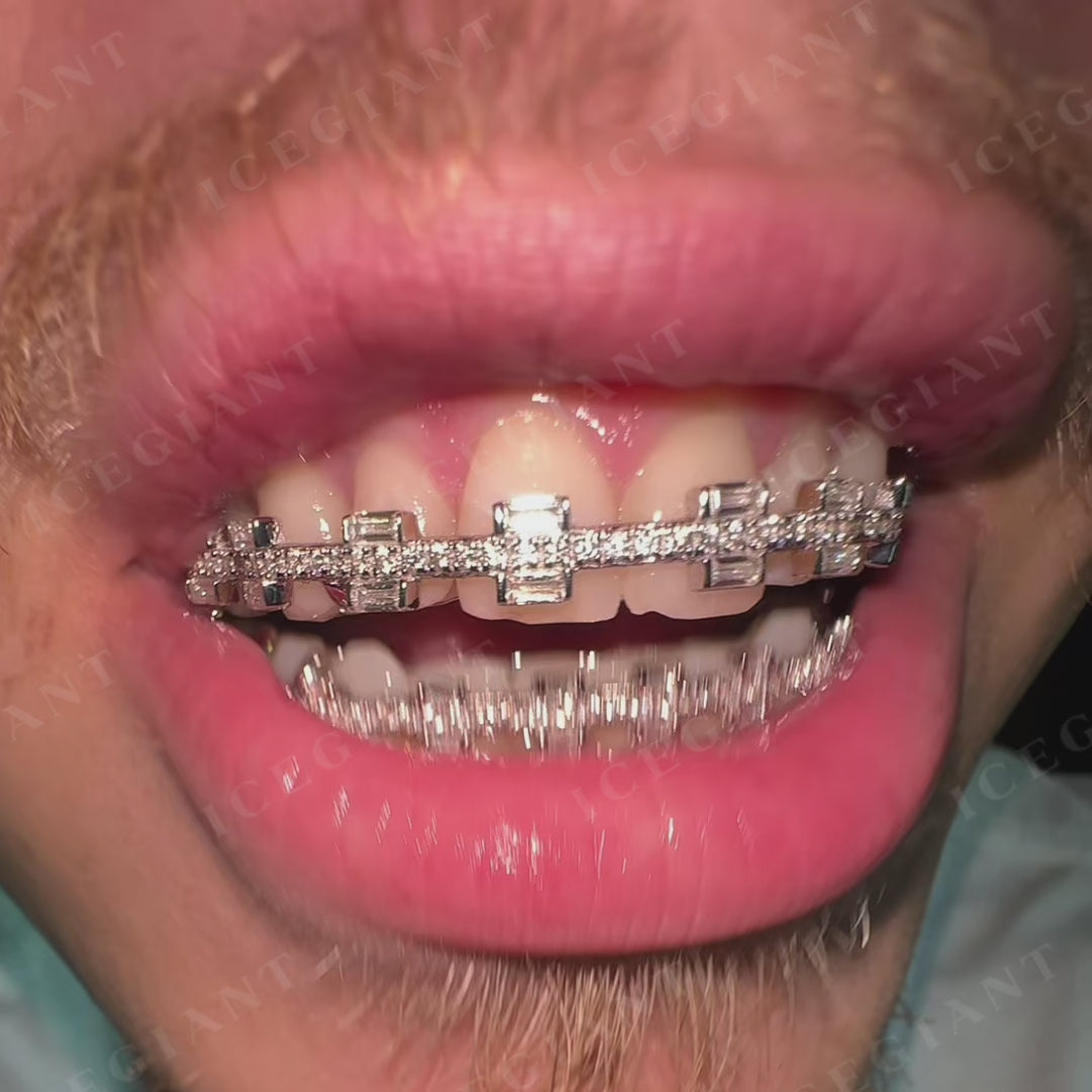 Rectangular Cut Brace Style Grillz