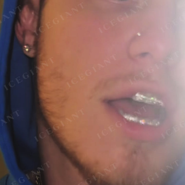 Rectangular Cut Brace Style Grillz