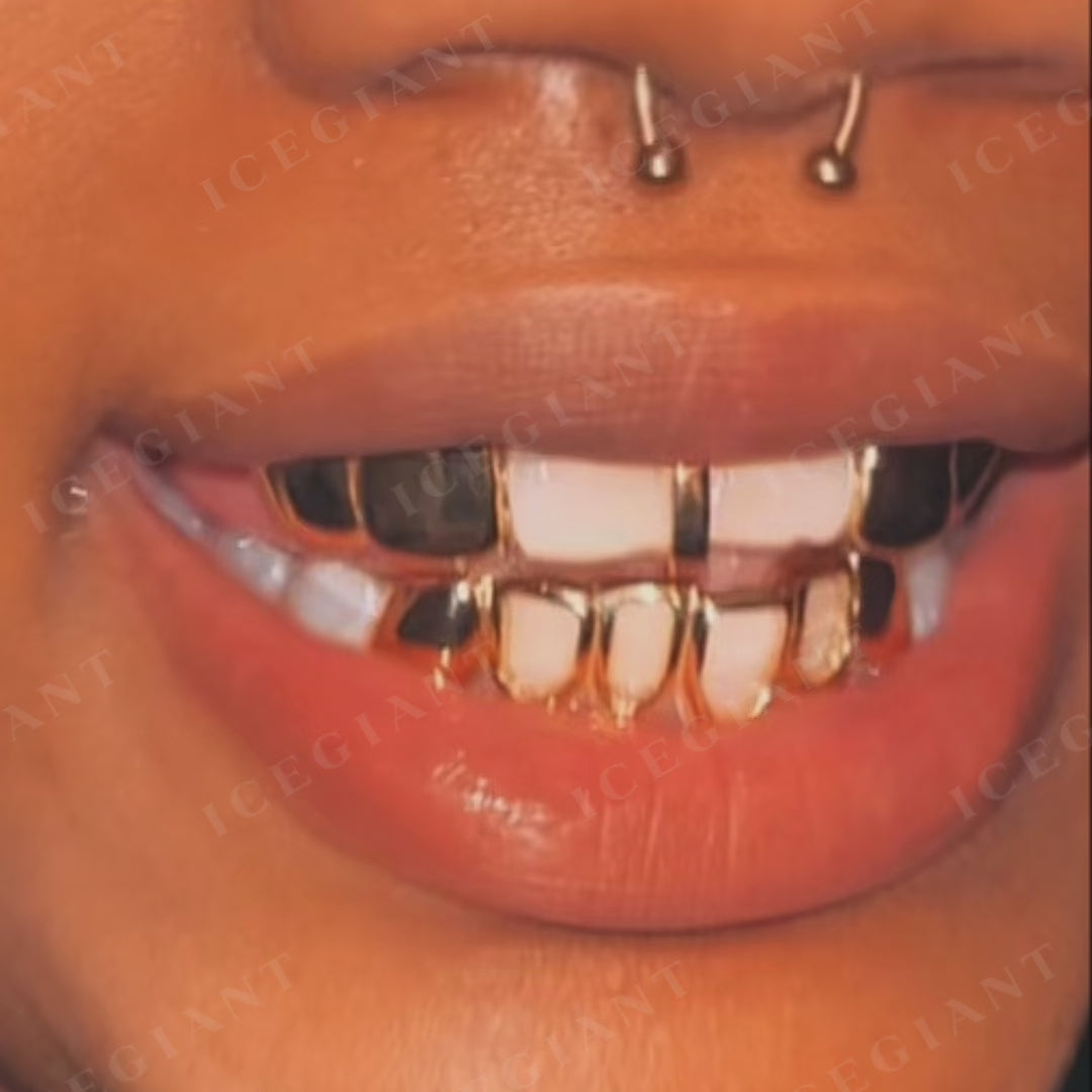 "Starburst Star" Open-Face Custom Grillz